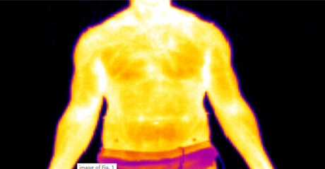 红外热像仪对皮肤进行智能体温检测